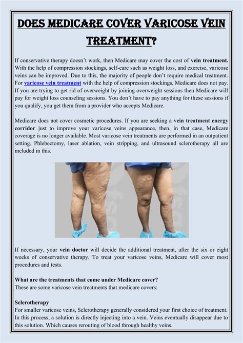 Does medicare cover spider vein treatment
