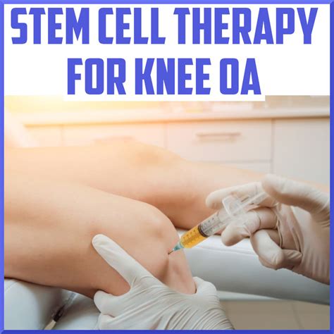 Where can i get stem cell treatment for knee