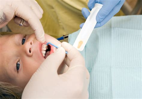 When can i brush my teeth after fluoride treatment