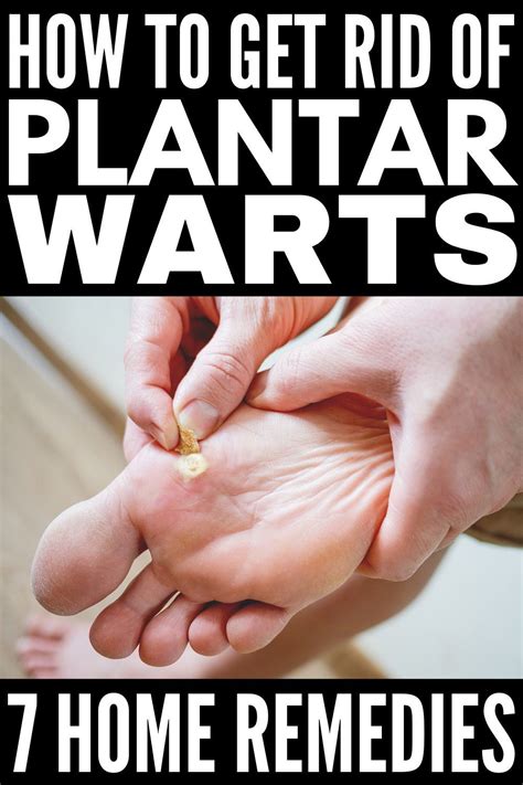Plantar wart treatment near me